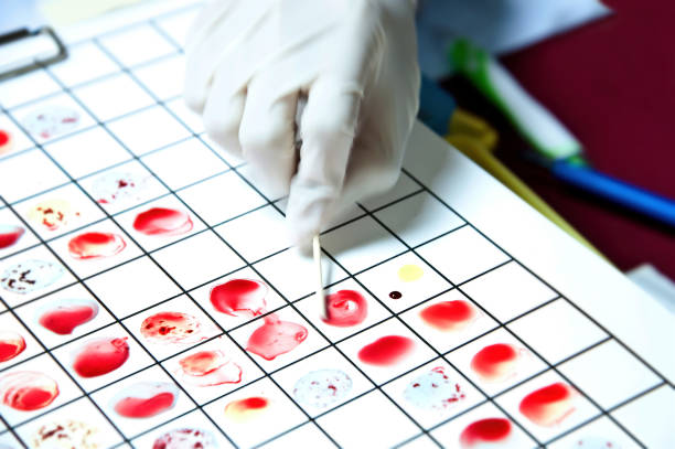 ABO Group and Rh Type blood grouping test procedure