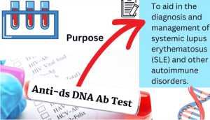 Anti-DNA Test