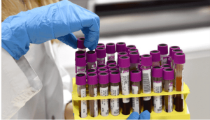 Antihyaluronidase Titer