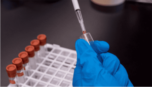 Antineutrophil Antibody Test