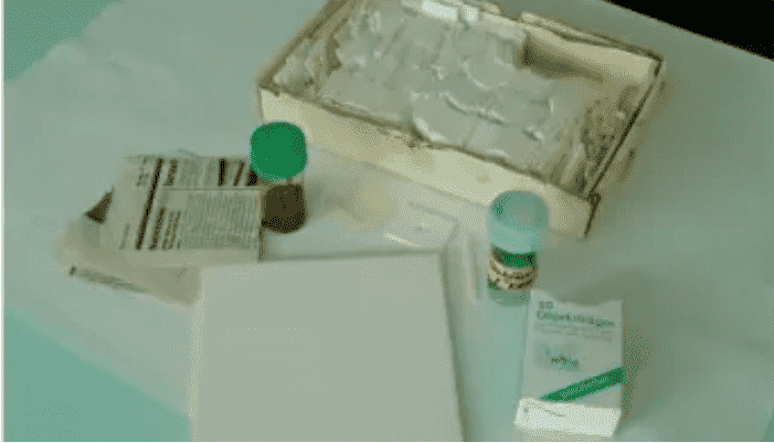 Ascariasis Serological Test