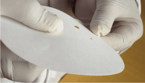 Duke Bleeding Time Test procedure for platelet function evaluation
