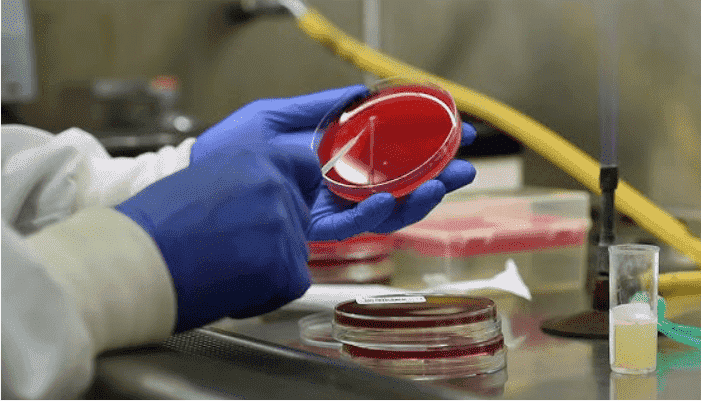 Cerebrospinal Fluid (CSF) Culture