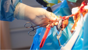 Cord Blood Screen