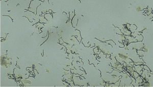 Darkfield Microscopy for Syphilis