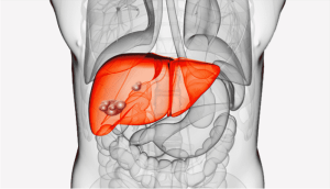 Echinococcosis Serological Test