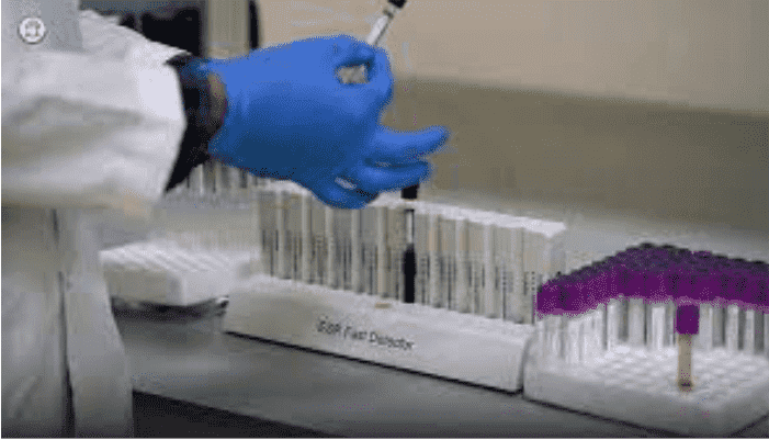 ESR (Erythrocyte Sedimentation Rate)