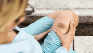 Factor II (Prothrombin)