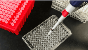 G-6-PD Quantitative Test