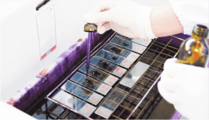 Gram Stain