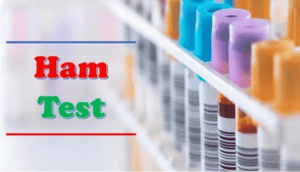 Ham Test (Acid Serum Test)