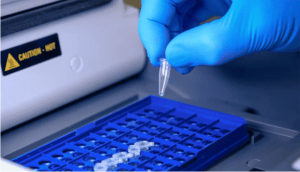 Hepatitis B DNA Detection Test