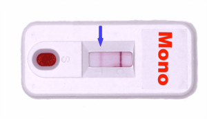 Infectious Mononucleosis Screening Test 