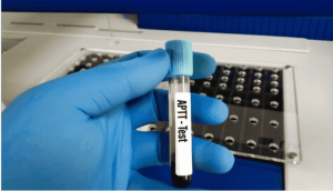 partial-thromboplastin-time-aptt