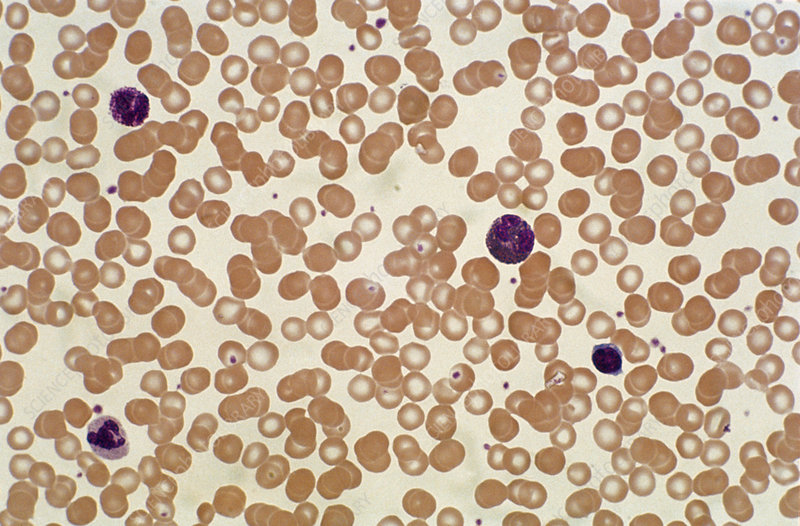 Peripheral Blood Smear: Red Blood Cell Morphology