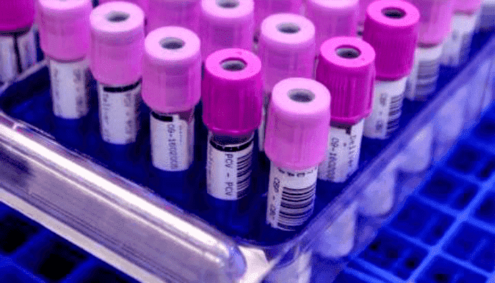 platelet-adhesion-test