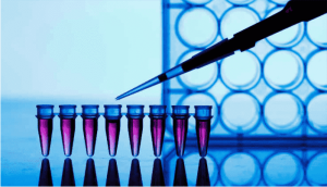 Polymerase Chain Reaction (PCR) Test