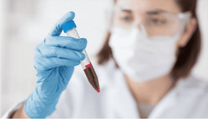 protein-c-blood-test
