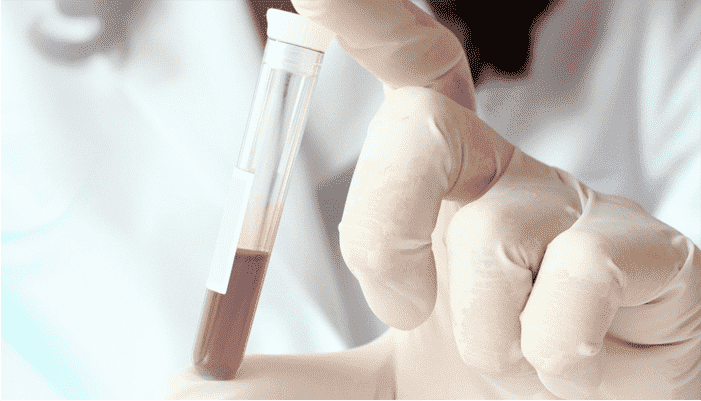 Protein S blood test in blue top citrate tube