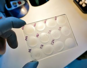 RPR Test for Syphilis