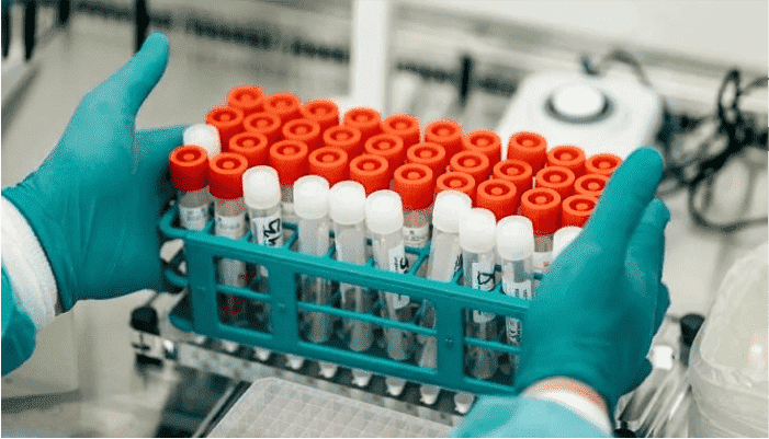 Schilling Test
