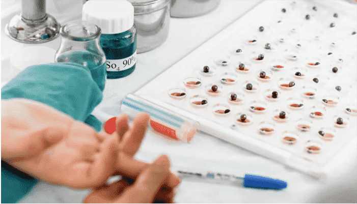 Sickle Cell Test