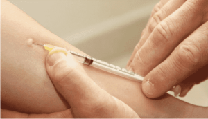Tuberculosis Skin Test (PPD) – Procedure, Interpretation, and Limitations