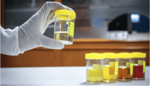 Urine Culture (Clean Catch)