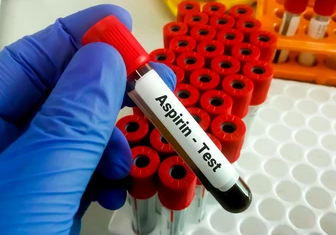 Aspirin Tolerance Test bleeding time procedure