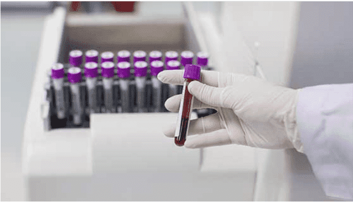 von Willebrand Factor Assay